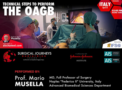 Immagine dell’evento One Anastomosis Gastric Bypass (OAGB)