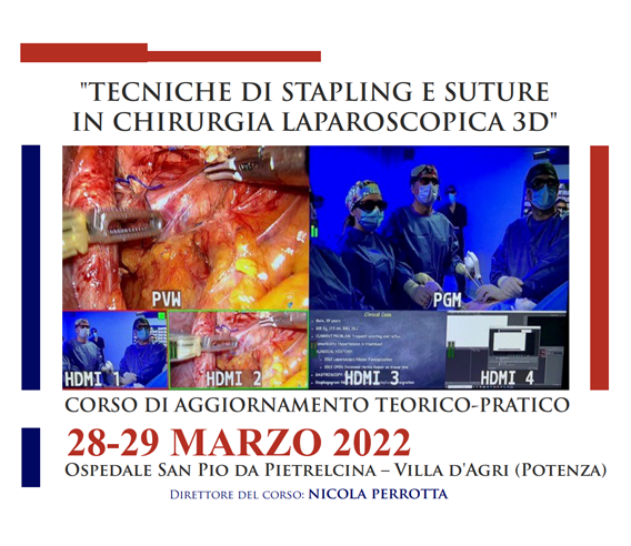 Immagine dell’evento TECNICHE DI STAPLING E SUTURE IN CHIRURGIA LAPAROSCOPICA 3D
